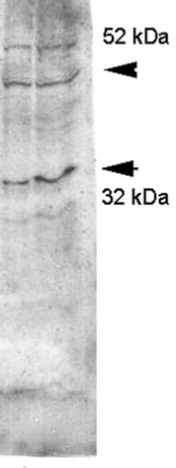 Aquaporin-4 Antibody, Novus Biologicals 0.1mL; Unlabeled:Antibodies, Polyclonal
